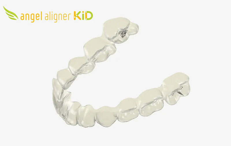 Angel Aligner KiD