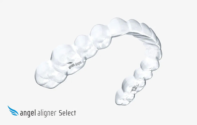 Angel Aligner Select